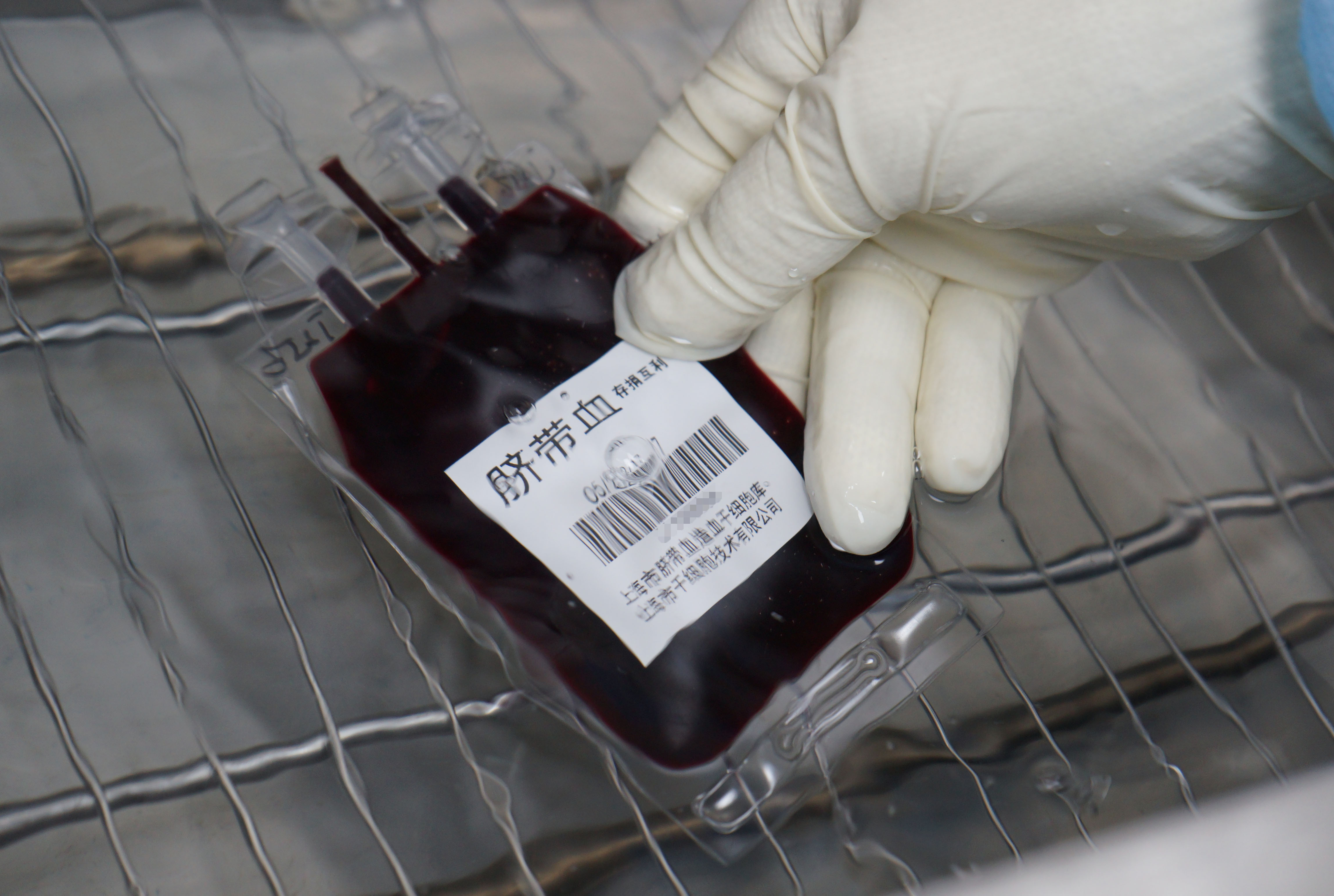 5-脐带血造血干细胞完成复苏.jpg