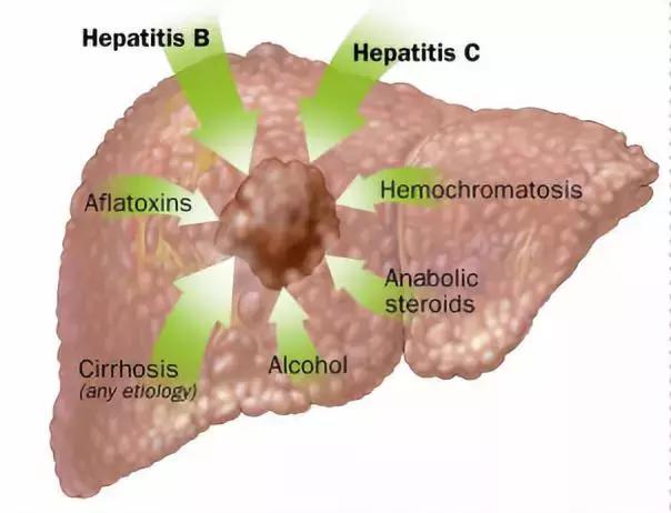 哈佛大学最新研究：全谷物饮食可降低 40% 肝细胞肝癌的发生率！