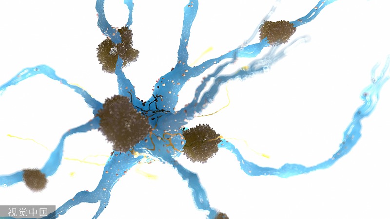 神经元.jpg