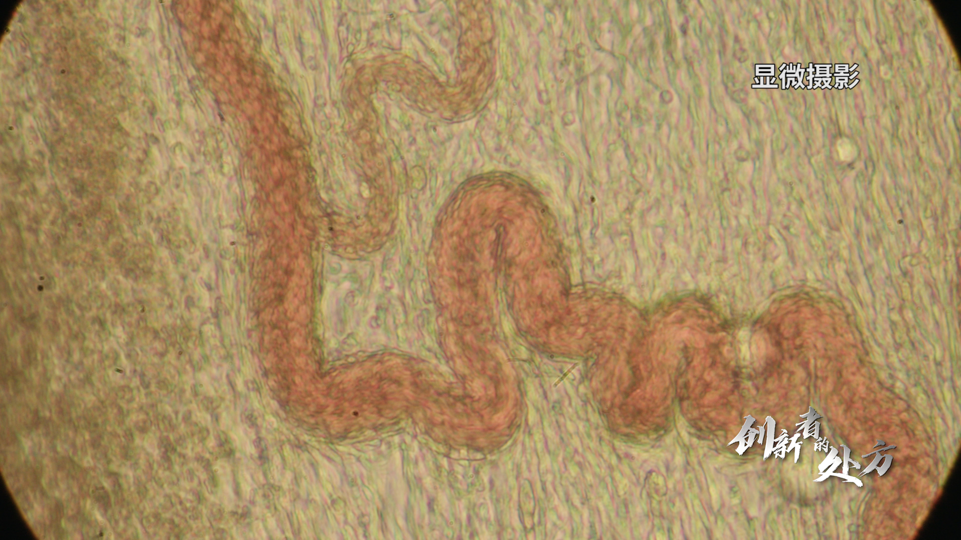 图4：显微摄影下的血管.jpg