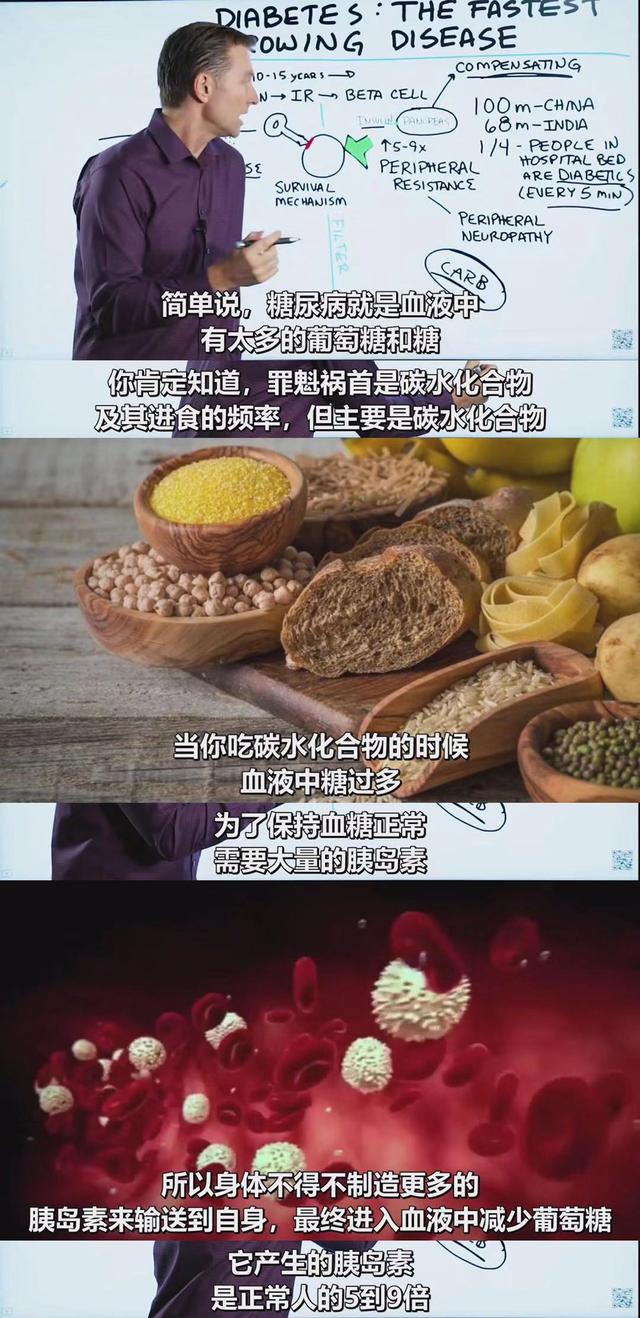 终于有医生说实话了：不吃碳水化合物，就能逆转90%的2型糖尿病