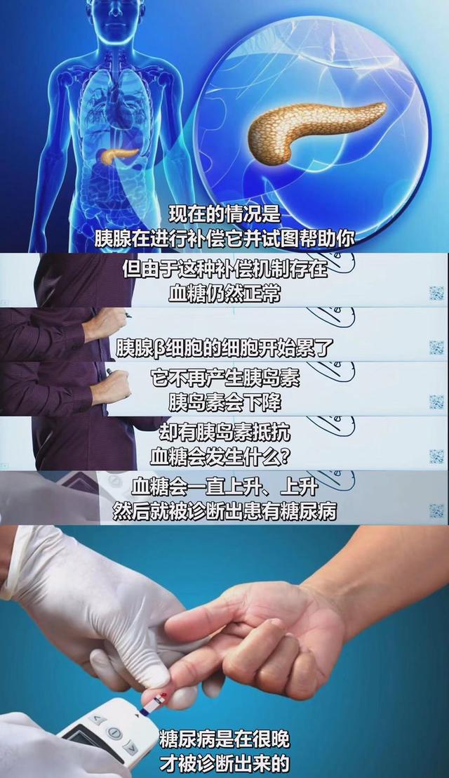 终于有医生说实话了：不吃碳水化合物，就能逆转90%的2型糖尿病