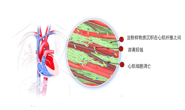 内16193526_副本.png